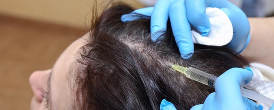 hair transplantation